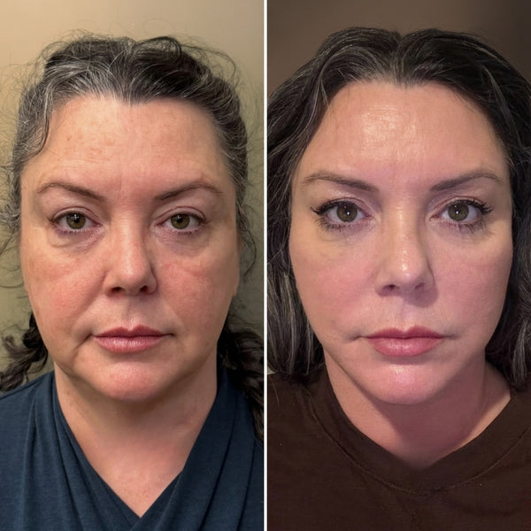 Lymfedrainage Gezichtsborstel – Voor een Frisse & Gedefinieerde Look